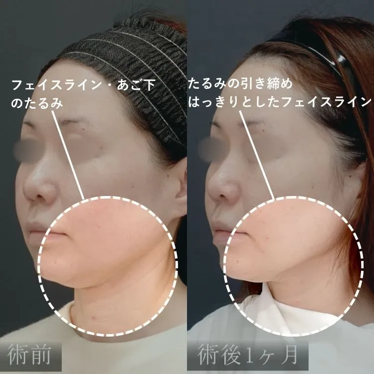症例