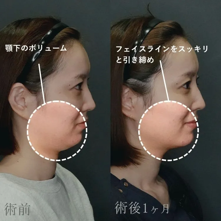 症例