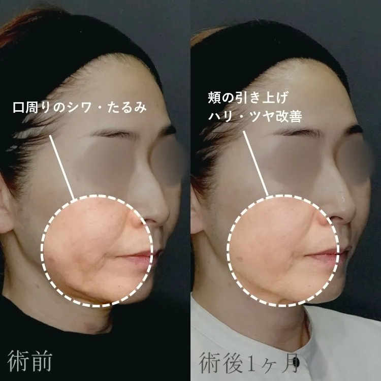 症例