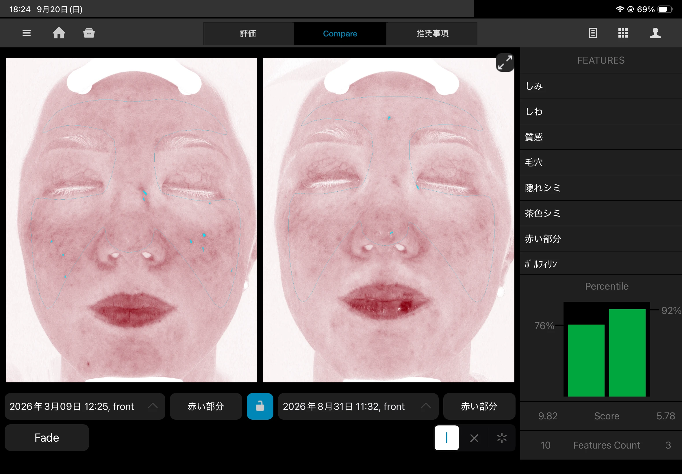 治療前後の効果を画像と数値で比較できる