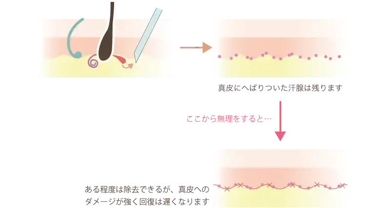 吸引法