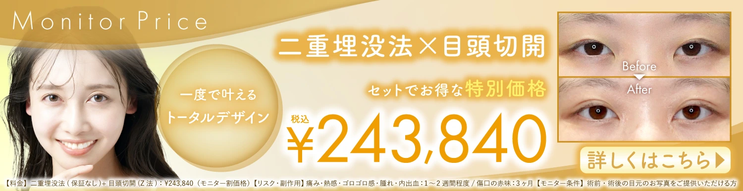 モニタープライス 二重埋没方×目頭切開