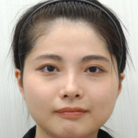 目頭切開 目 二重 美容整形 美容外科なら水の森美容外科 公式 総合サイト 目頭切開 目 二重 美容整形 美容外科なら水の森美容外科 公式 総合サイト