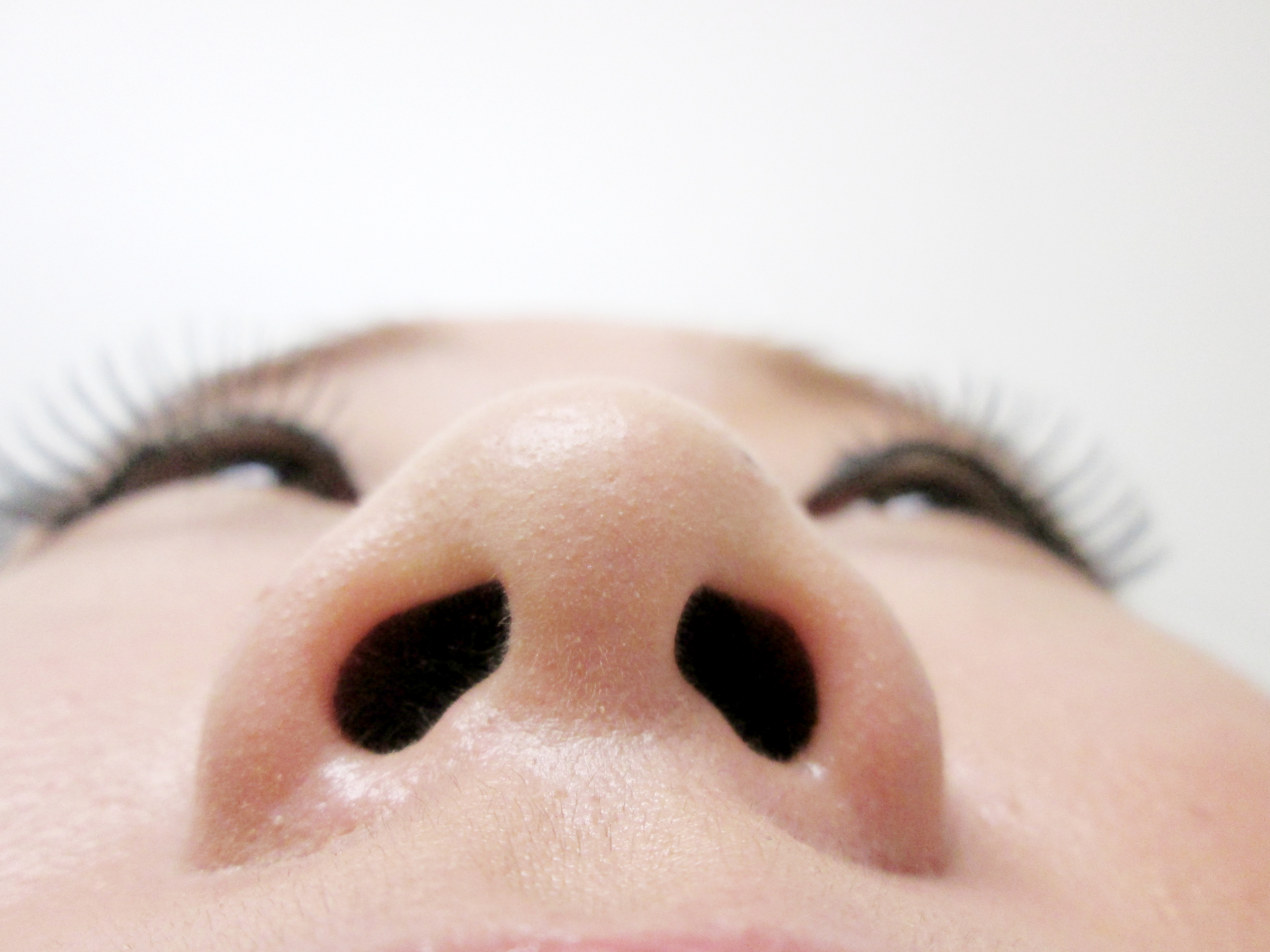 鼻プロテーゼ・鼻中隔延長施術前下から写真