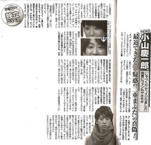 【週刊女性】にNEWSの小山慶一郎さんの”疑惑の二重まぶた”の真相について竹江渉総院長が取材を受けました。