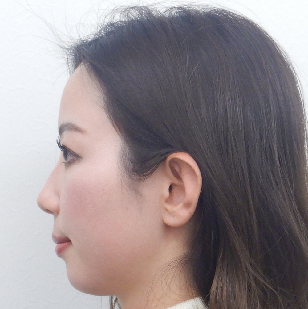 施術前横