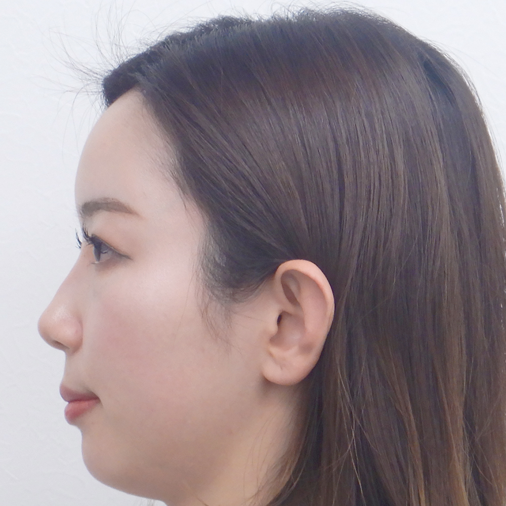 施術後横