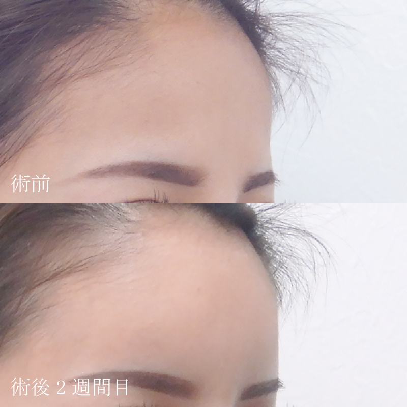 額HA_2022.4.27_龍田