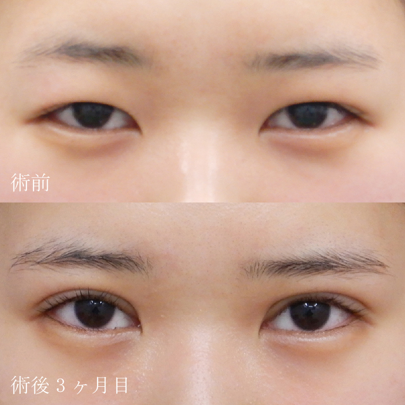 症例