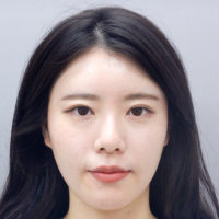 涙袋へのヒアルロン酸注入の症例一覧 美容整形 美容外科なら水の森美容クリニック 公式 総合サイト