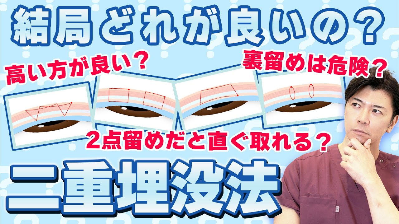 高い埋没法と安い埋没法 一体何が違うの？？ 良い埋没法の種類を見抜く方法教えます！