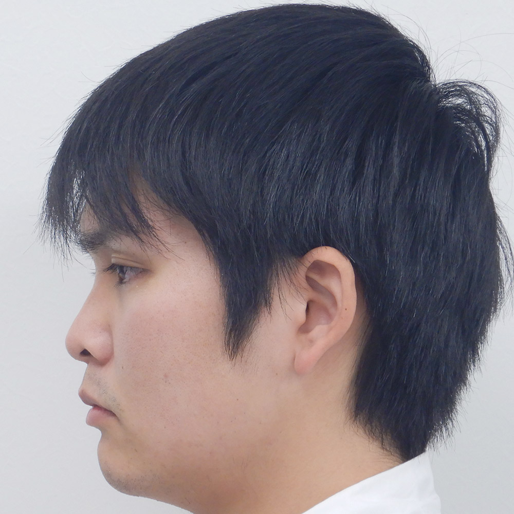 施術前横