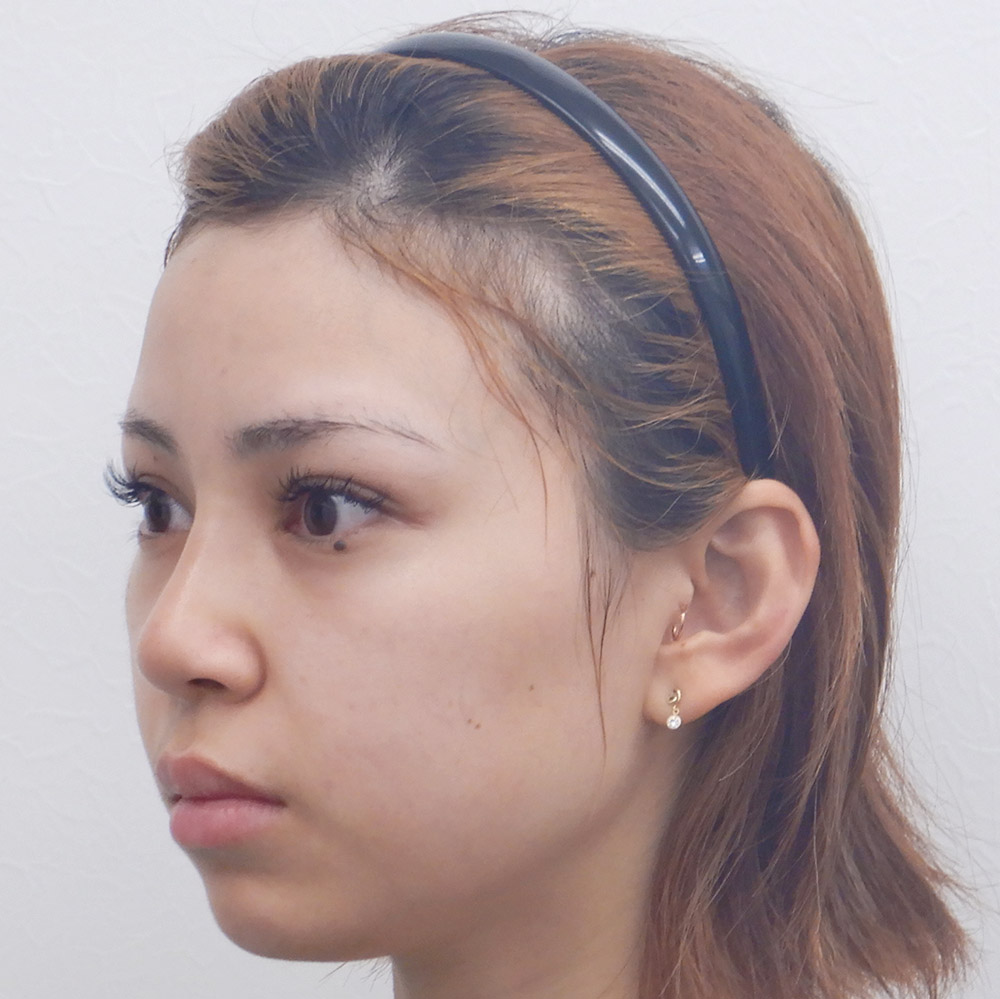 施術後横