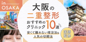 アイムに掲載されました