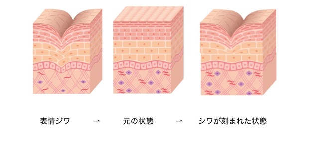 表情ジワの断面