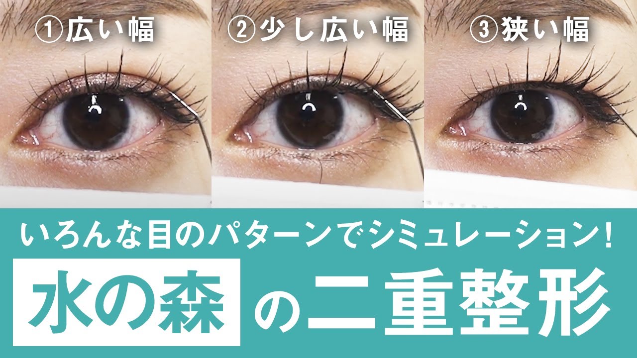 【二重整形】どの幅が1番似合う？総勢6名の二重シミュレーションを大公開