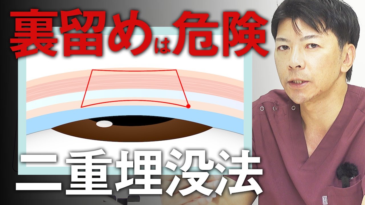 二重埋没法“裏留め”のリスク｜後遺症の危険もあるため要注意【水の森美容クリニック】