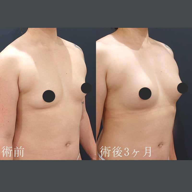症例