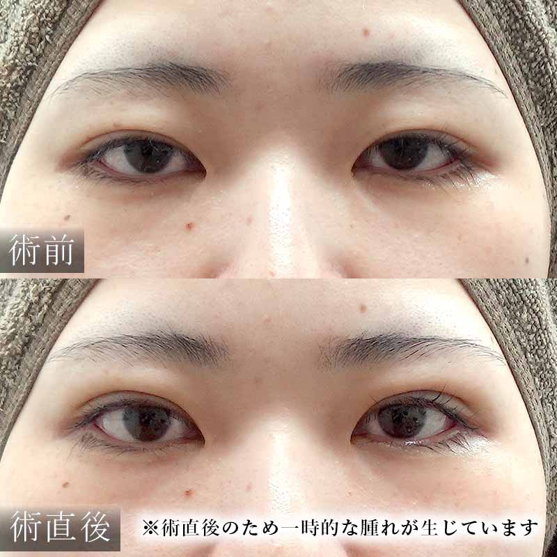 20241015_O112357_sugishima_double-burial-method