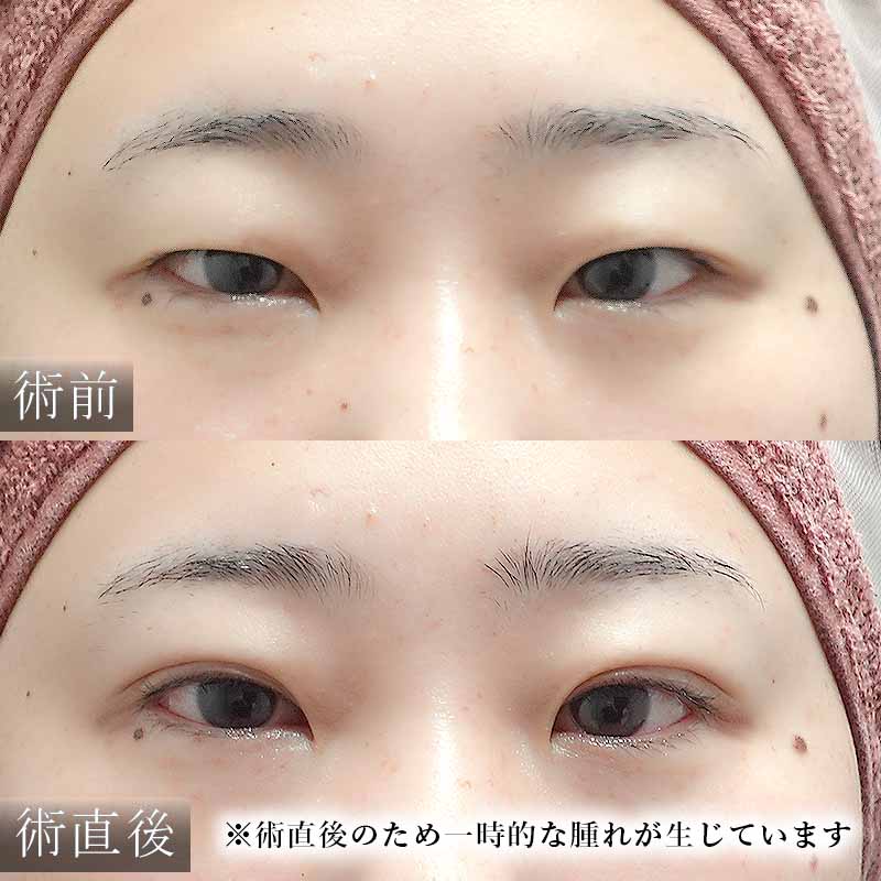 20241207_S113233_ono_double-burial-method