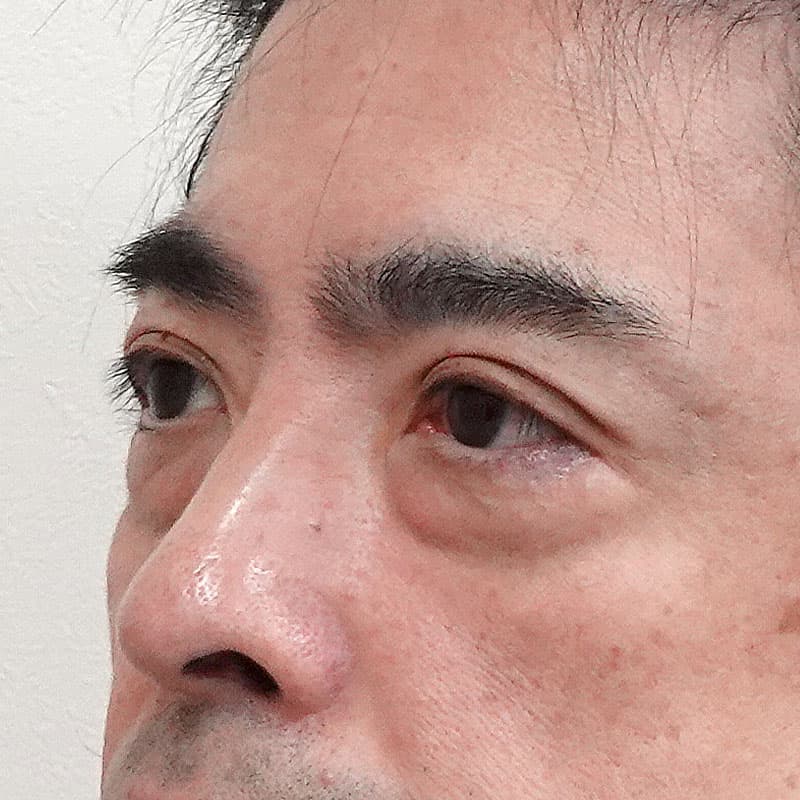 20250430_S109444_suzuki_hamura-method①Before