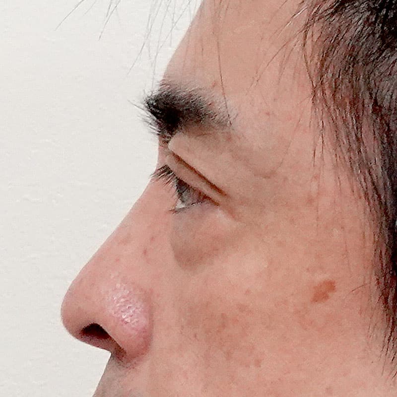 20250430_S109444_suzuki_hamura-method②Before