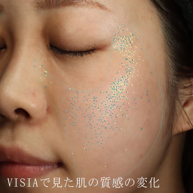 20250823_St20250823-1_blessing①Before