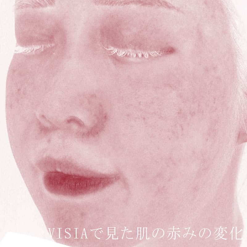 20250823_St20250823-1_blessing③After