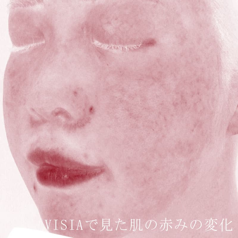 20250823_St20250823-1_blessing③Before