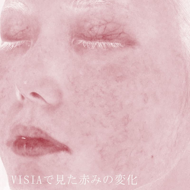 20250823_St20250823_blessing①After