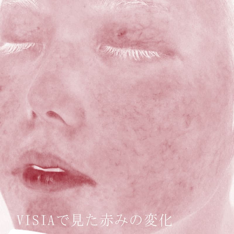 20250823_St20250823_blessing①Before