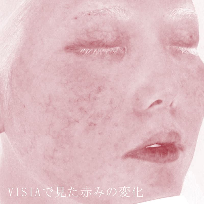20250823_St20250823_blessing③After