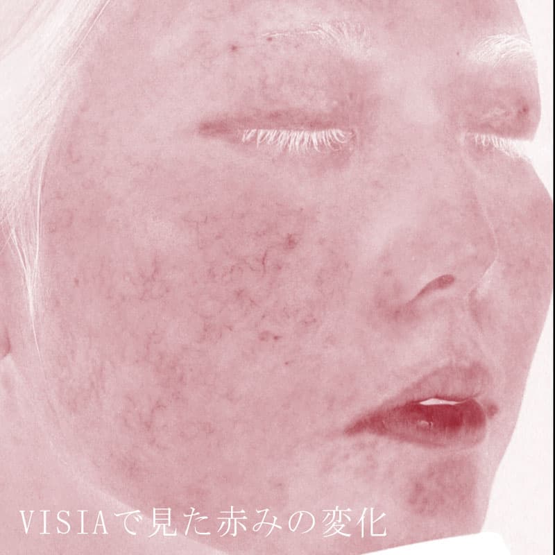 20250823_St20250823_blessing③Before