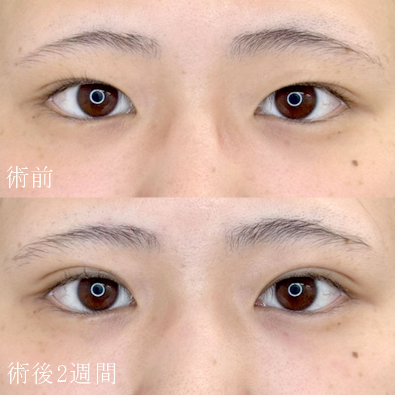 20251023_F150603_kadoya_double-burial-methodメイン横