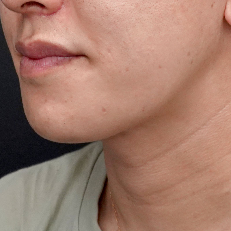 20251102_G127067_nishida_Mental formation -1①After