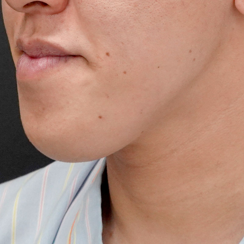 20251102_G127067_nishida_Mental formation -1①Before