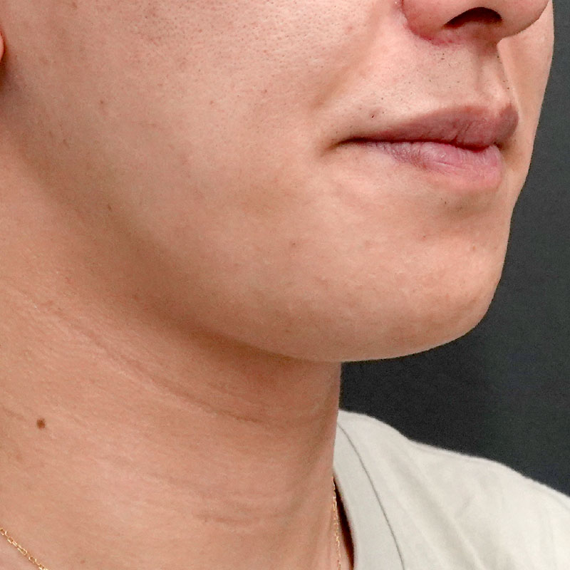 20251102_G127067_nishida_Mental formation -1②After