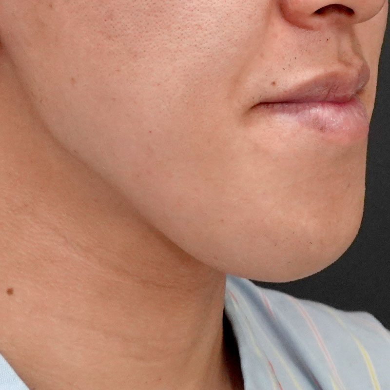 20251102_G127067_nishida_Mental formation -1②Before