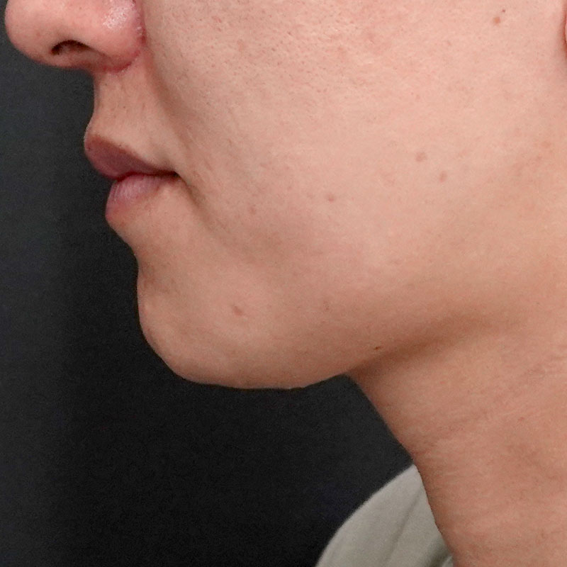 20251102_G127067_nishida_Mental formation -1③After_1