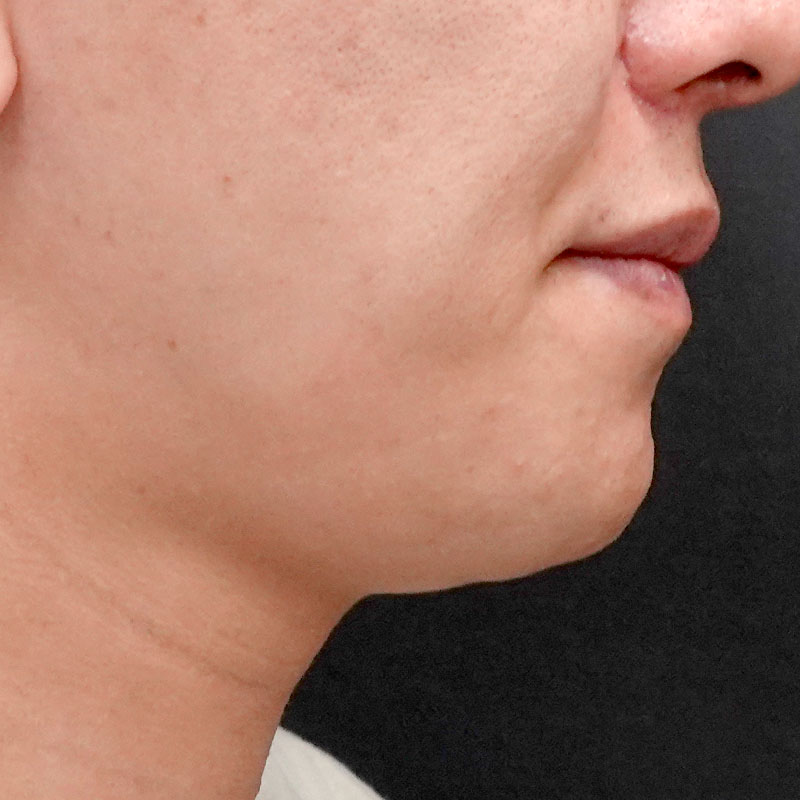 20251102_G127067_nishida_Mental formation -1③After_2