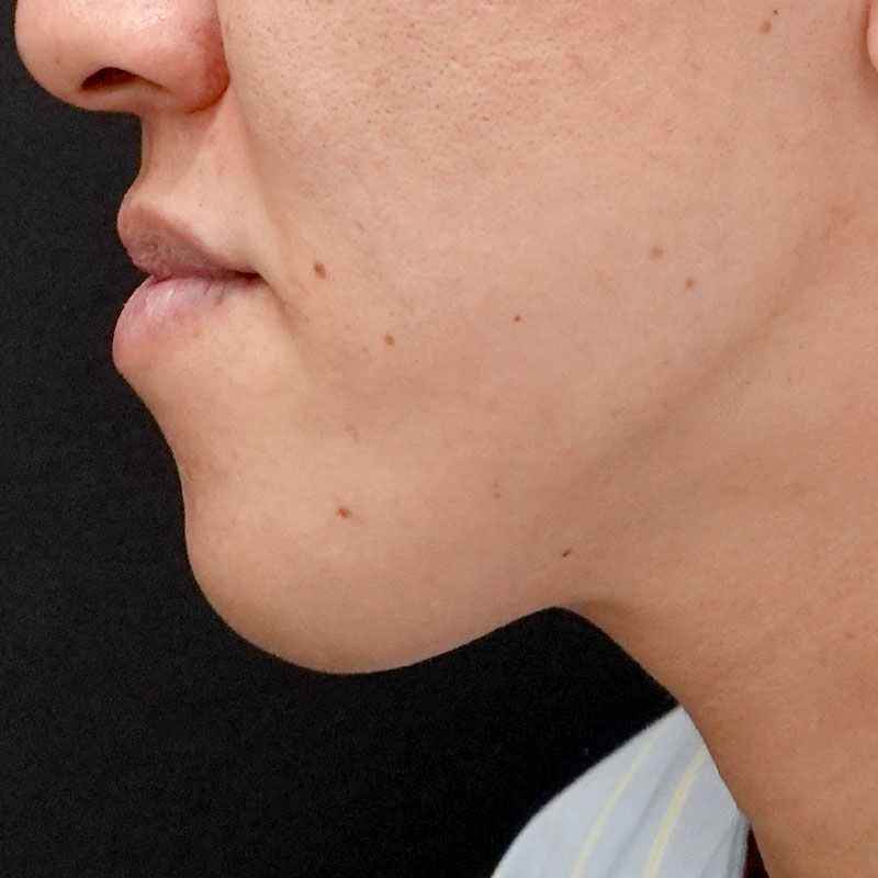 20251102_G127067_nishida_Mental formation -1③Before_1