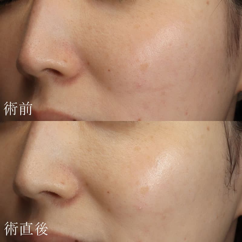 ララドクター症例写真①