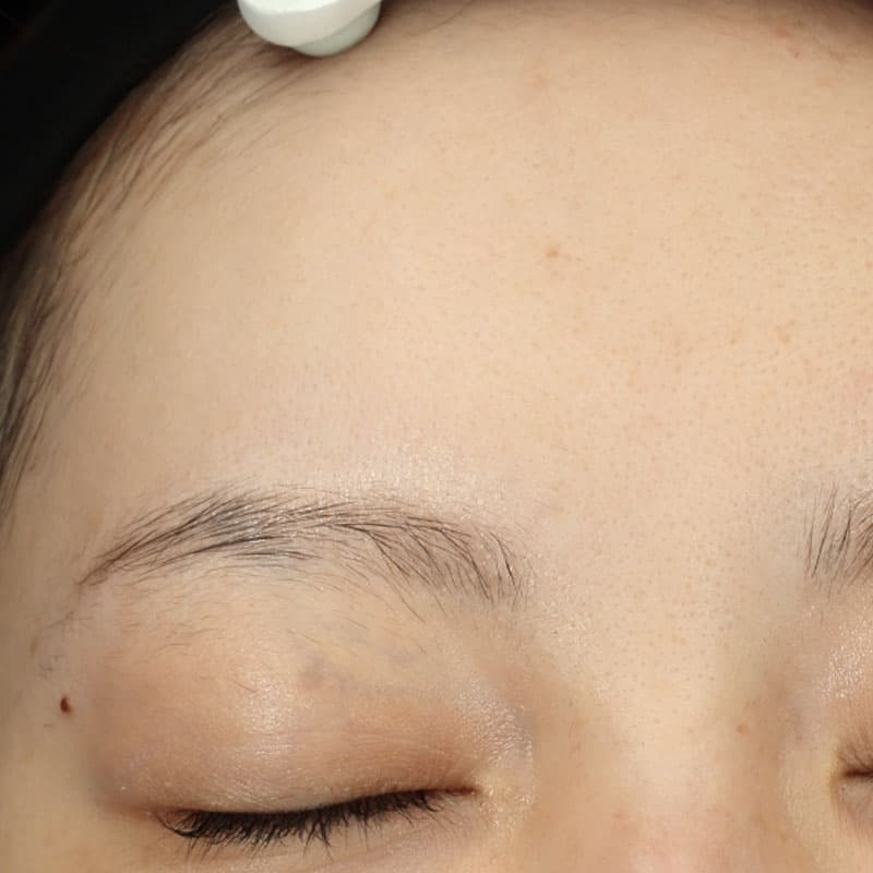 20251117_St202051117_Lhala doctor①After