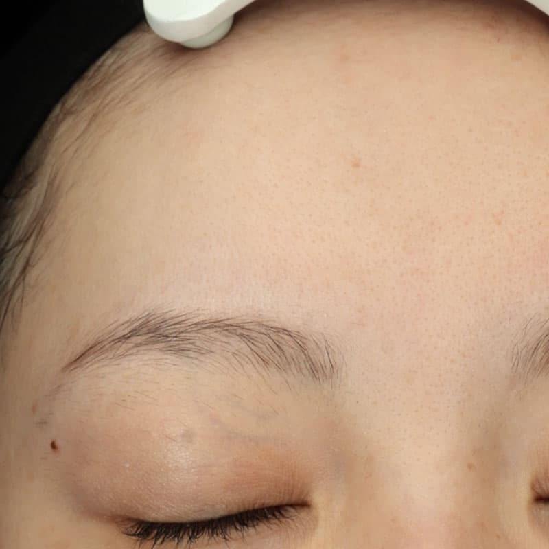 20251117_St202051117_Lhala doctor①Before