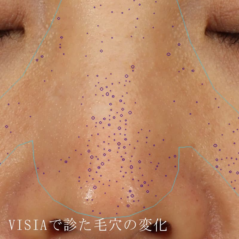 20251117_St20251117-1_Lhala doctor①Before