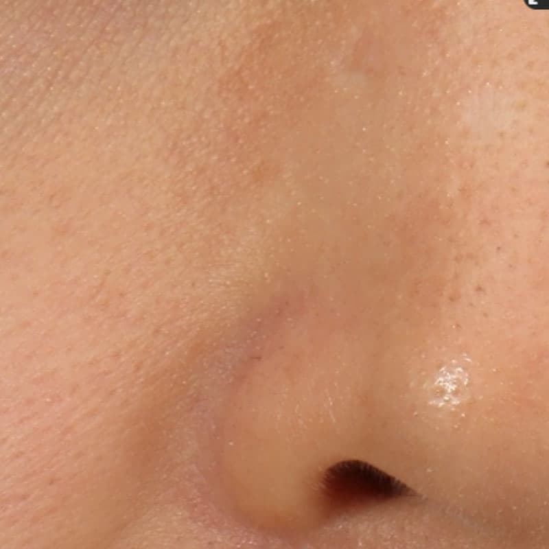 20251117_St20251117-1_Lhala doctor②After