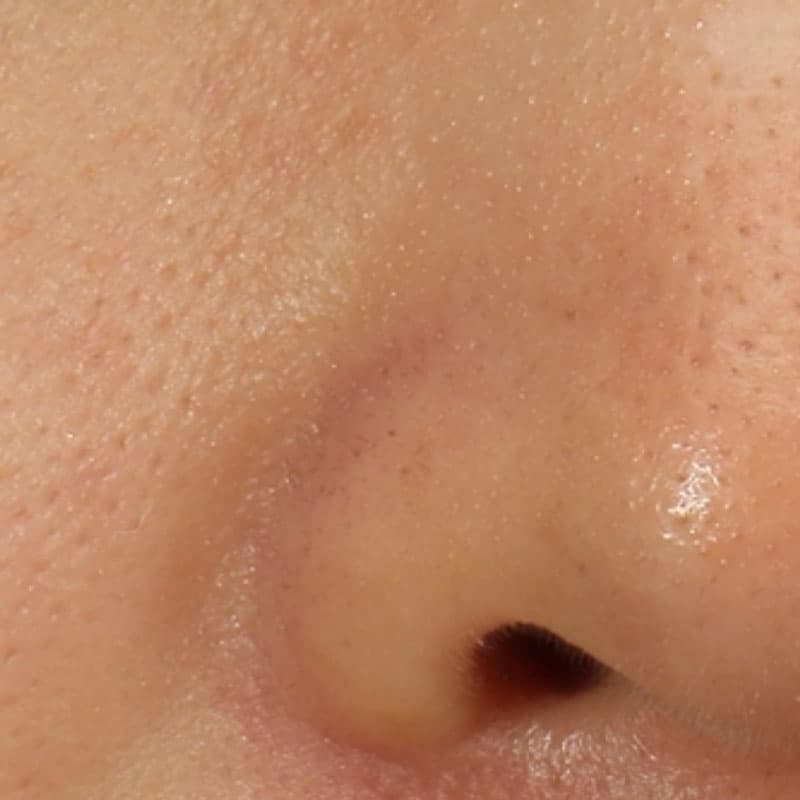 20251117_St20251117-1_Lhala doctor②Before