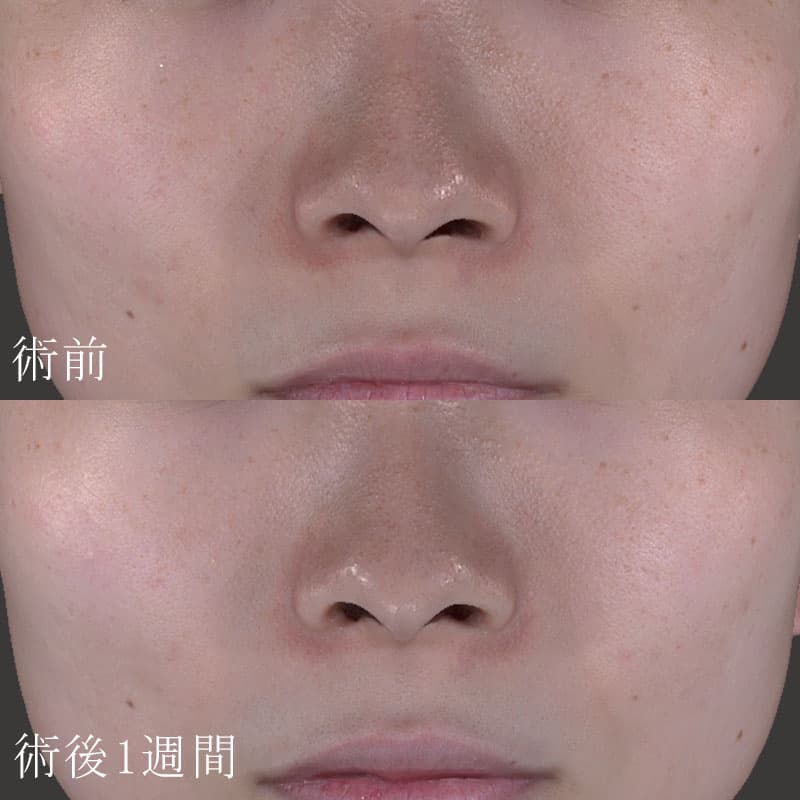 ララドクター症例写真②