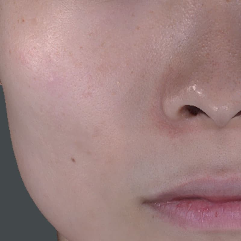 20251122_St20251122-6_Lhala doctor①After