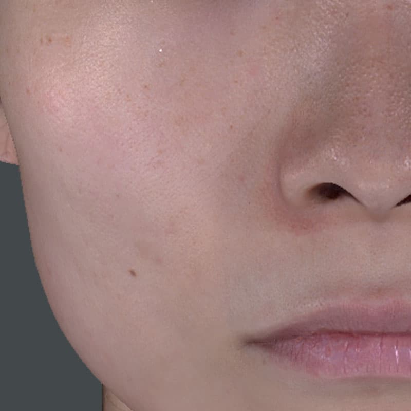 20251122_St20251122-6_Lhala doctor①Before